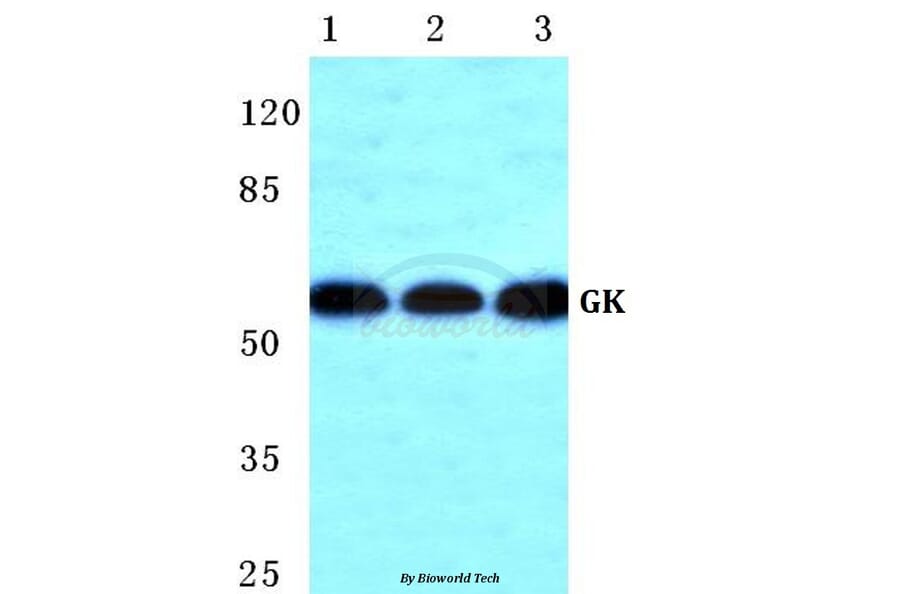 Anti-GK Antibody from Bioworld Technology (BS5733) - Antibodies.com