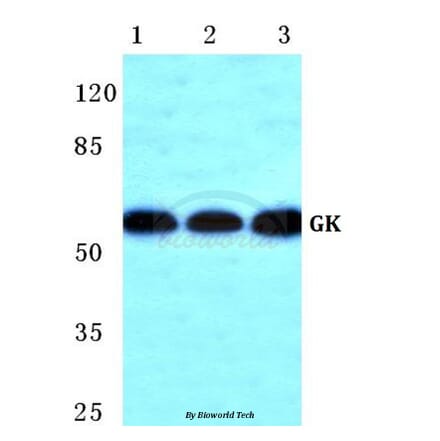 Anti-GK Antibody from Bioworld Technology (BS5733) - Antibodies.com