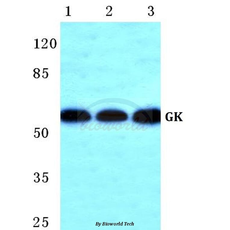 Anti-GK Antibody from Bioworld Technology (BS5733) - Antibodies.com