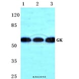 Anti-GK Antibody from Bioworld Technology (BS5733) - Antibodies.com