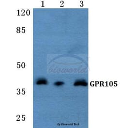Anti-GPR105 Antibody from Bioworld Technology (BS5738) - Antibodies.com