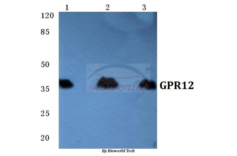 Anti-GPR12 Antibody from Bioworld Technology (BS5739) - Antibodies.com