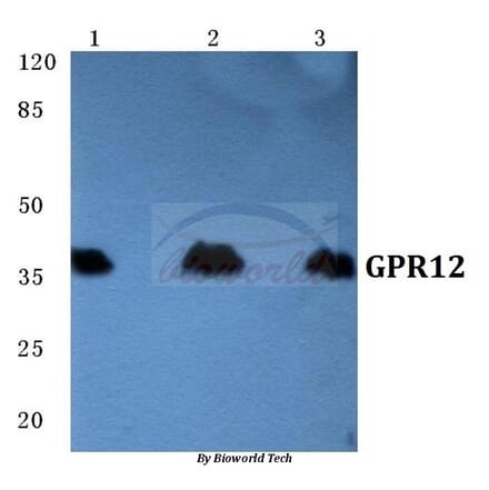 Anti-GPR12 Antibody from Bioworld Technology (BS5739) - Antibodies.com