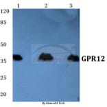 Anti-GPR12 Antibody from Bioworld Technology (BS5739) - Antibodies.com