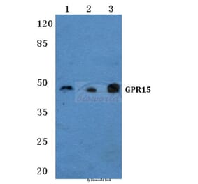 Anti-GPR15 Antibody from Bioworld Technology (BS5740) - Antibodies.com