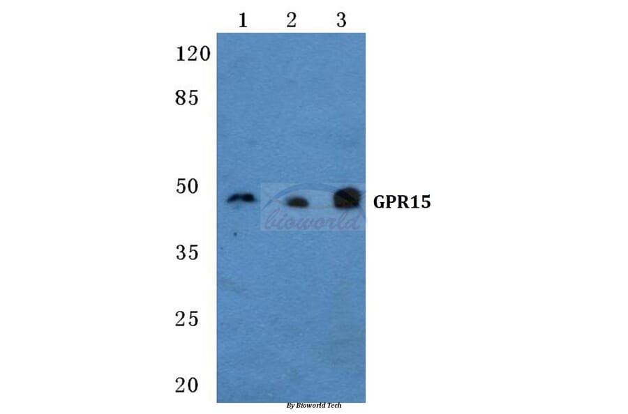 Anti-GPR15 Antibody from Bioworld Technology (BS5740) - Antibodies.com