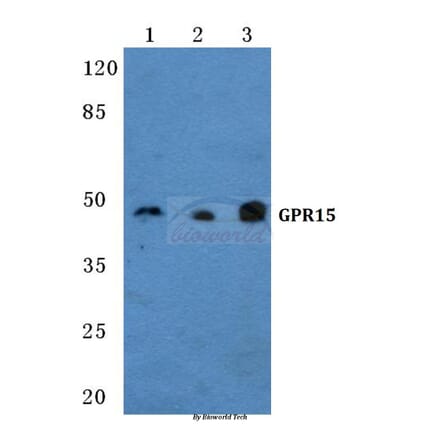 Anti-GPR15 Antibody from Bioworld Technology (BS5740) - Antibodies.com