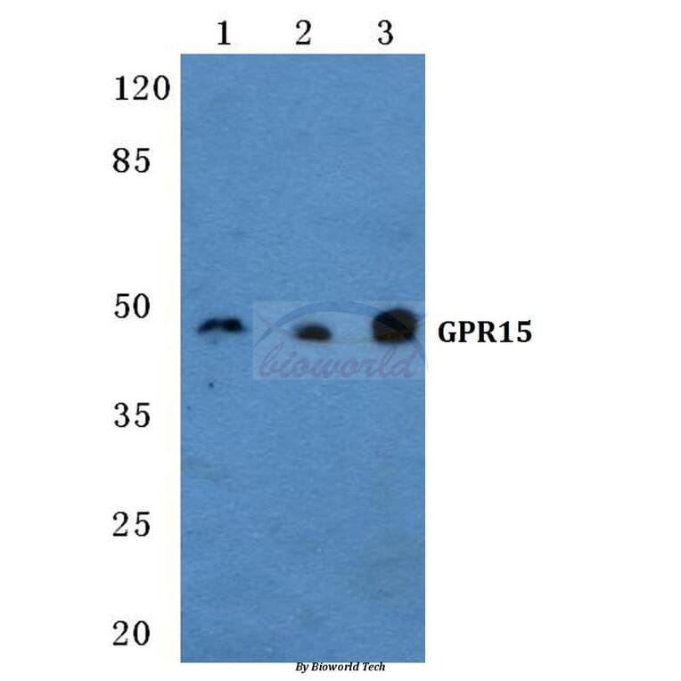 Anti-GPR15 Antibody from Bioworld Technology (BS5740) - Antibodies.com
