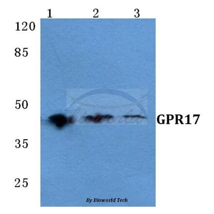 Anti-GPR17 Antibody from Bioworld Technology (BS5741) - Antibodies.com