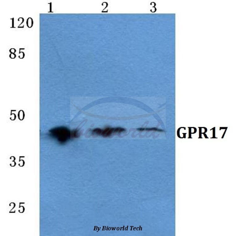 Anti-GPR17 Antibody from Bioworld Technology (BS5741) - Antibodies.com