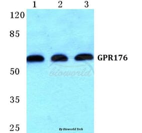 Anti-GPR176 Antibody from Bioworld Technology (BS5743) - Antibodies.com