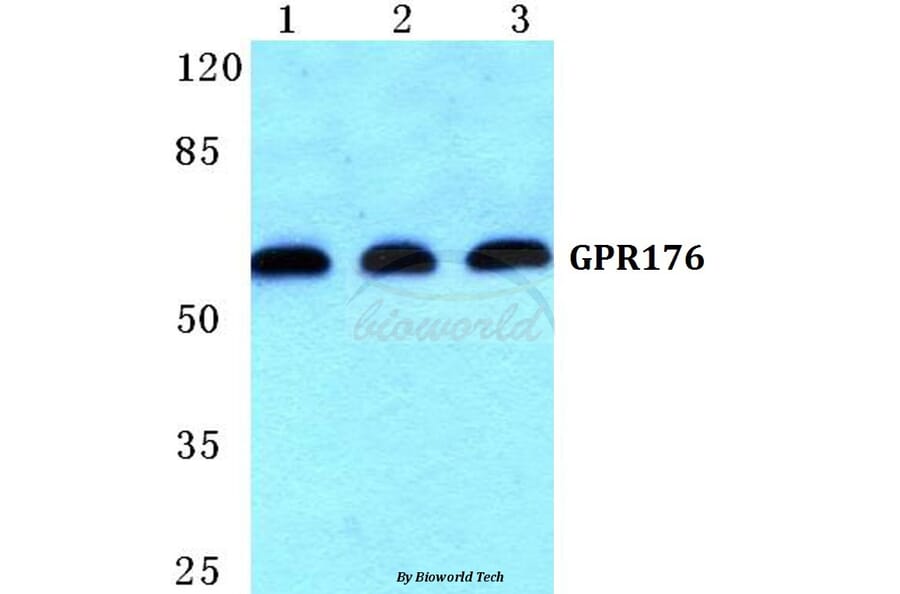 Anti-GPR176 Antibody from Bioworld Technology (BS5743) - Antibodies.com