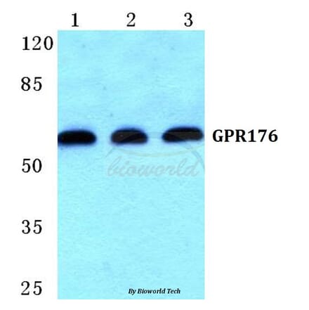 Anti-GPR176 Antibody from Bioworld Technology (BS5743) - Antibodies.com