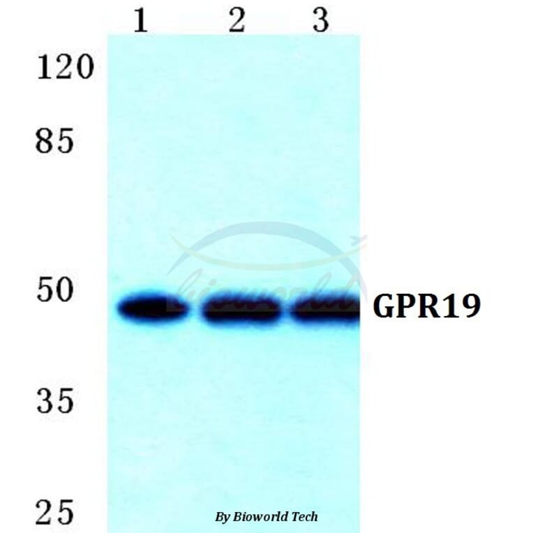 Anti-GPR19 Antibody from Bioworld Technology (BS5745) - Antibodies.com
