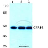 Anti-GPR19 Antibody from Bioworld Technology (BS5745) - Antibodies.com