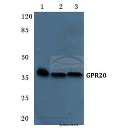 Anti-GPR20 Antibody from Bioworld Technology (BS5746) - Antibodies.com