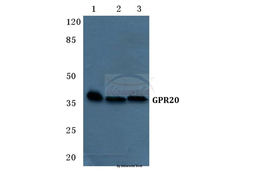 Anti-GPR20 Antibody from Bioworld Technology (BS5746) - Antibodies.com