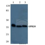 Anti-GPR20 Antibody from Bioworld Technology (BS5746) - Antibodies.com