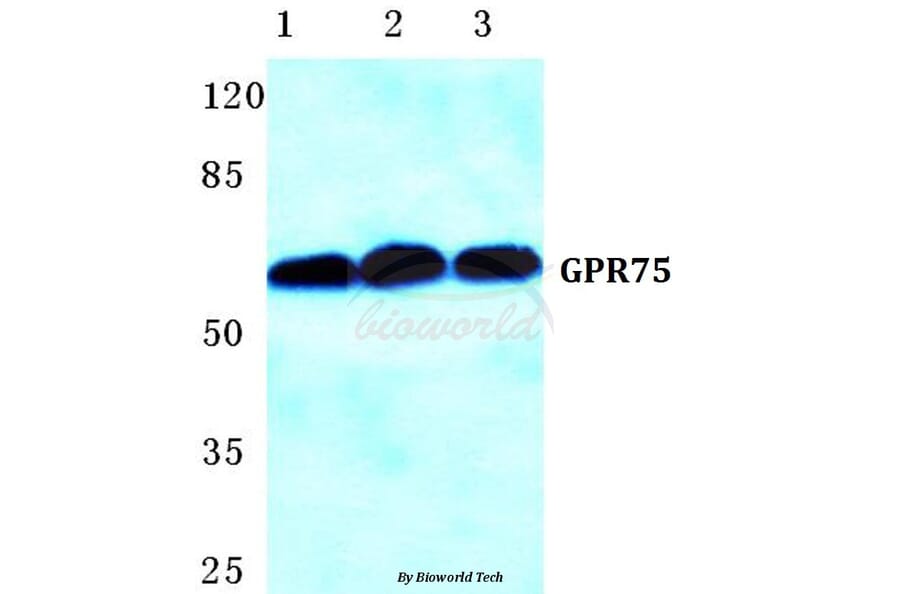 Anti-GPR75 Antibody from Bioworld Technology (BS5752) - Antibodies.com