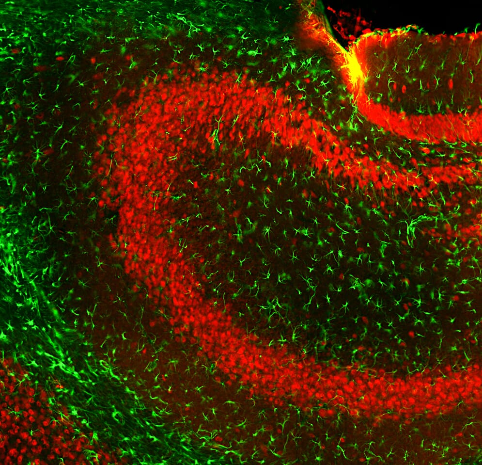 Immunofluorescent analysis of mouse hippocampus section stained with Anti-GFAP Antibody (A270545), at a dilution of 1:5,000, in green. The tissue was co-stained with Anti-Fox3 Antibody (A85404), at a dilution of 1:2,000, in red. Nuclear DNA is visualised in blue using Hoechst staining. Following transcardial perfusion of the mouse with 4% paraformaldehyde, the brain was post-fixed for 24 hours, cut to 45 µm, and free-floating sections were stained with the above antibodies. The Anti-GFAP Antibody (A270545) stains the network of astrocytic glial cells, while the Anti-Fox3 Antibody (A85404) specifically labels nuclei and proximal perikarya of neurons.