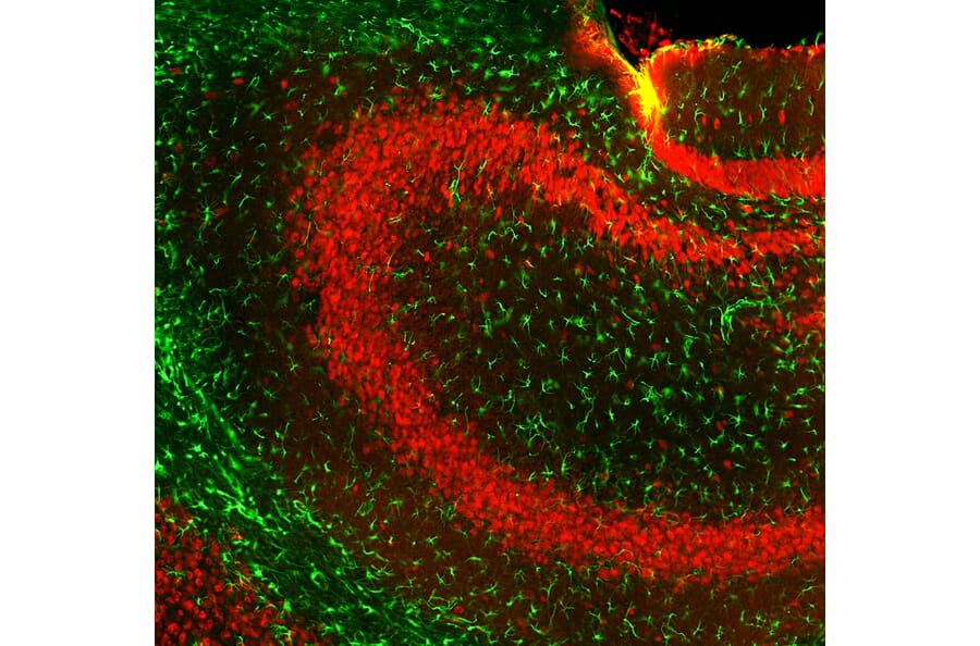 IHC of mouse hippocampus using Anti-GFAP Antibody (A270545)