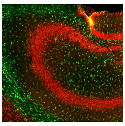 Immunofluorescence - Anti-GFAP Antibody (A270545) - Antibodies.com