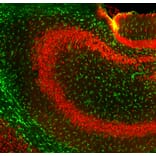 Immunofluorescence - Anti-GFAP Antibody (A270545) - Antibodies.com