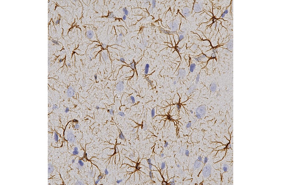 Immunohistochemistry - Anti-GFAP Antibody (A270545) - Antibodies.com