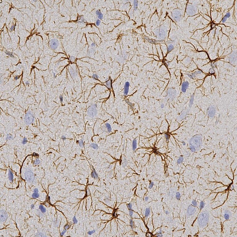 Immunohistochemistry - Anti-GFAP Antibody (A270545) - Antibodies.com