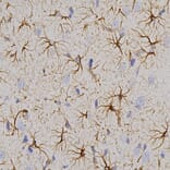 Immunohistochemistry - Anti-GFAP Antibody (A270545) - Antibodies.com