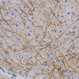 Immunohistochemistry - Anti-Myelin Basic Protein Antibody (A270546) - Antibodies.com