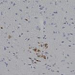 Immunohistochemistry - Anti-mCherry Antibody (A270547) - Antibodies.com