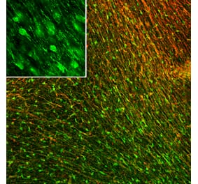 Immunofluorescence - Anti-FABP7 Antibody [2A84] (A270549) - Antibodies.com