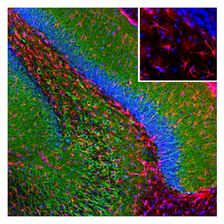 Immunofluorescence - Anti-GFAP Antibody [3E10] (A270551) - Antibodies.com