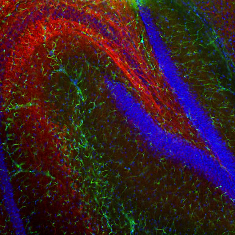 Immunofluorescence - Anti-GFAP Antibody [3E10] (A270551) - Antibodies.com