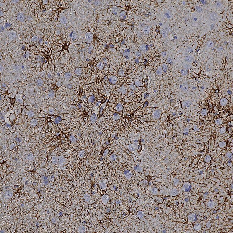 Immunohistochemistry - Anti-GFAP Antibody [3E10] (A270551) - Antibodies.com
