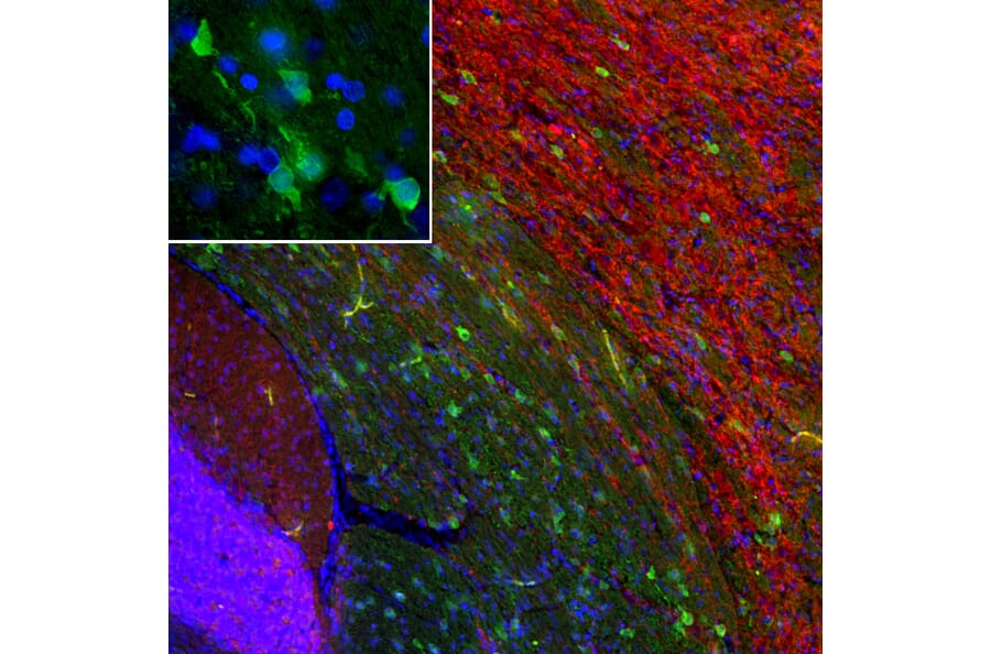 Immunofluorescence - Anti-PEA15 Antibody [4D117] (A270552) - Antibodies.com