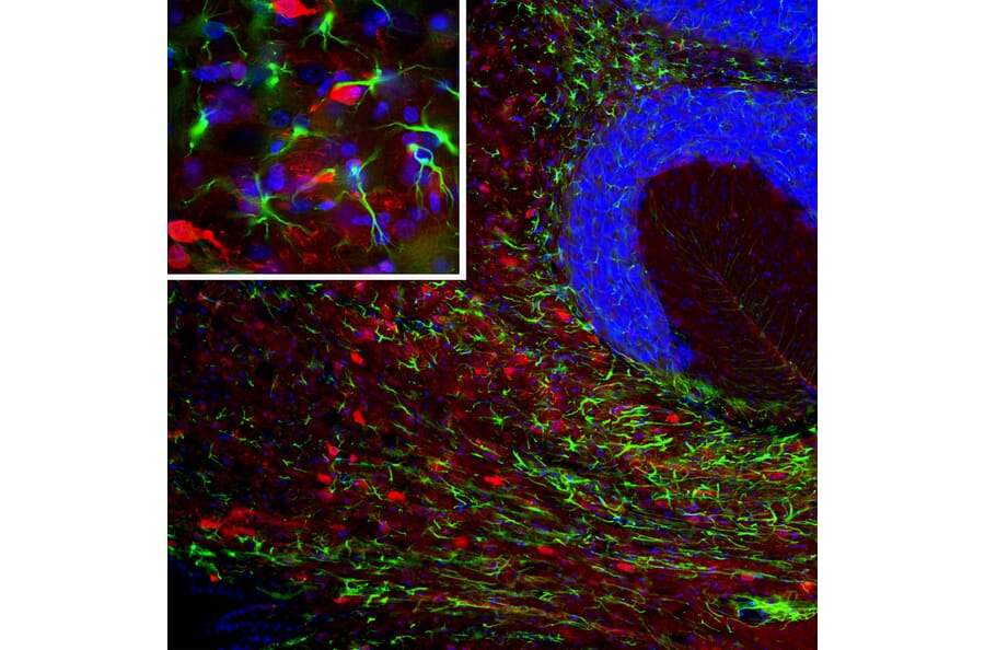 Immunofluorescence - Anti-PEA15 Antibody [4D2] (A270553) - Antibodies.com