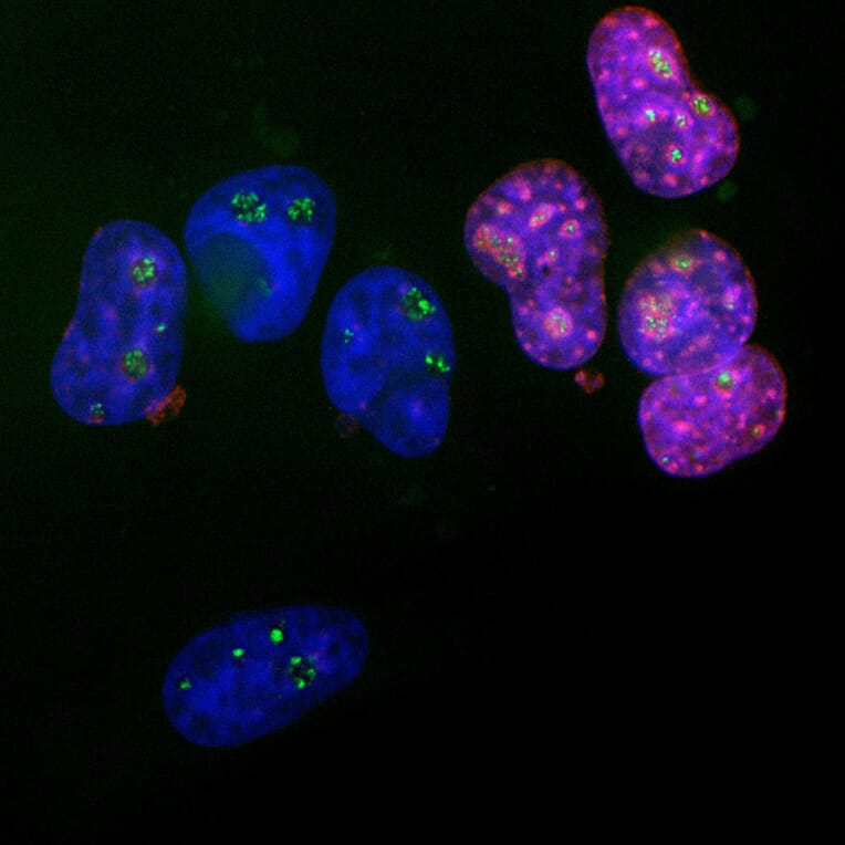 Immunofluorescence - Anti-Ki67 Antibody [5F86] (A270555) - Antibodies.com