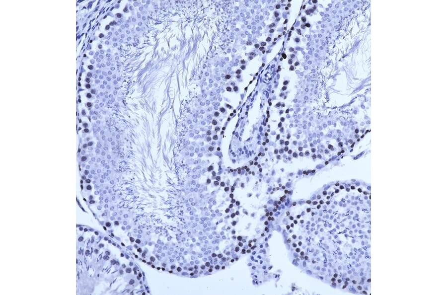 Immunohistochemistry - Anti-Ki67 Antibody [5F86] (A270555) - Antibodies.com