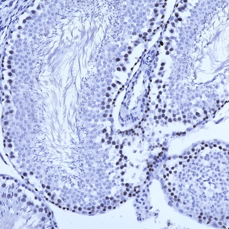 Immunohistochemistry - Anti-Ki67 Antibody [5F86] (A270555) - Antibodies.com