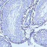Immunohistochemistry - Anti-Ki67 Antibody [5F86] (A270555) - Antibodies.com