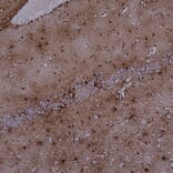 Immunohistochemistry - Anti-MARCKS Antibody [5F9] (A270556) - Antibodies.com