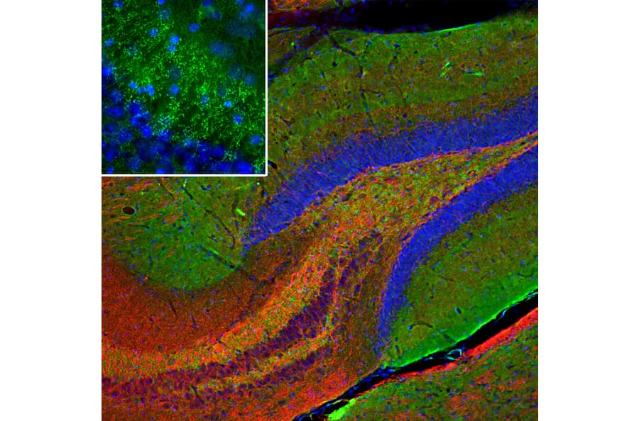 Immunofluorescence - Anti-beta Synuclein Antibody [6A10] (A270558) - Antibodies.com