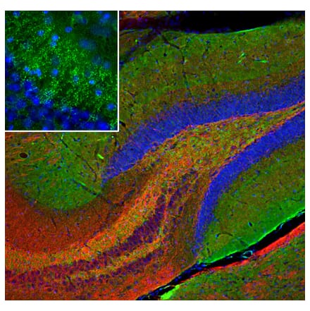 Immunofluorescence - Anti-beta Synuclein Antibody [6A10] (A270558) - Antibodies.com