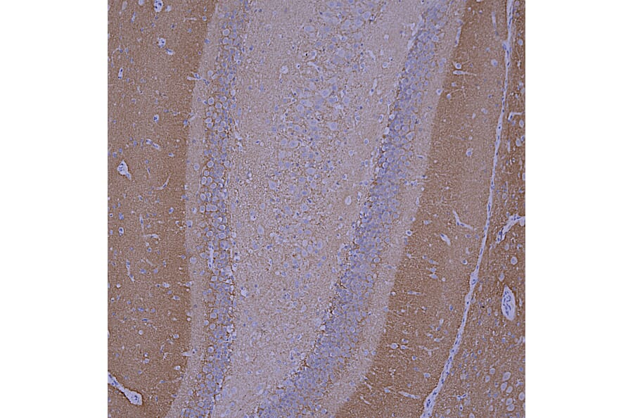 Immunohistochemistry - Anti-beta Synuclein Antibody [6A10] (A270558) - Antibodies.com