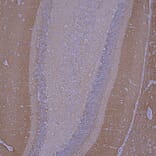 Immunohistochemistry - Anti-beta Synuclein Antibody [6A10] (A270558) - Antibodies.com