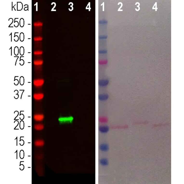 Western Blot - Anti-beta Synuclein Antibody [6A10] (A270558) - Antibodies.com