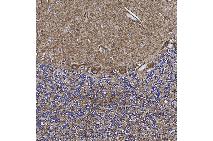 Immunohistochemistry - Anti-Annexin V Antibody [6A12] (A270559) - Antibodies.com