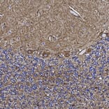 Immunohistochemistry - Anti-Annexin V Antibody [6A12] (A270559) - Antibodies.com